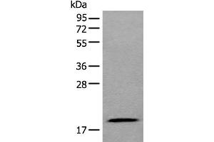 Western blot analysis of 293T cell lysate using ZNHIT1 Polyclonal Antibody at dilution of 1:400 (ZNHIT1 Antikörper)