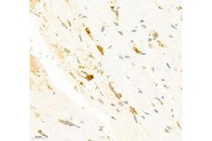 Immunohistochemistry of paraffin embedded mouse heart using SMYD2 (ABIN7075581) at dilution of 1:2000 (400x lens) (SMYD2A Antikörper)