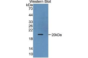 Western blot analysis of the recombinant protein. (IL17B Antikörper  (AA 21-180))