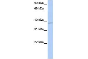 WB Suggested Anti-FGFR1OP Antibody Titration: 0. (FGFR1OP Antikörper  (Middle Region))