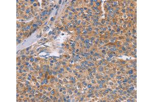 Immunohistochemistry (IHC) image for anti-Cell Division Cycle 7 (CDC7) antibody (ABIN2432827) (CDC7 Antikörper)