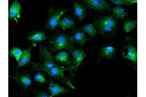 Anti-TUBAL3 mouse monoclonal antibody (ABIN2455275) immunofluorescent staining of COS7 cells transiently transfected by pCMV6-ENTRY TUBAL3 (RC216194). (TUBAL3 Antikörper  (AA 150-446))