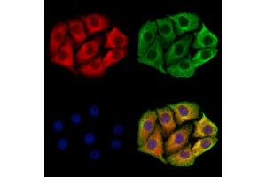 ABIN7094477 and ABIN7098525 staining Hela cells by IF/ICC.