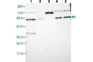 Western blot analysis of Lane 1: RT-4, Lane 2: U-251 MG, Lane 3: Human Plasma, Lane 4: Liver, Lane 5: Tonsil with HRC polyclonal antibody . (HRC Antikörper)
