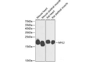 Western blot analysis of extracts of various cell lines using MYL2 Polyclonal Antibody at dilution of 1:500. (MYL2 Antikörper)