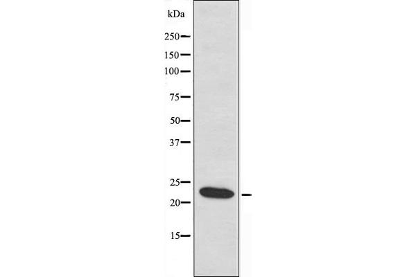 MRPL40 抗体  (C-Term)