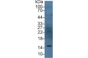 Detection of ANG in Human Serum using Polyclonal Antibody to Angiogenin (ANG) (ANG Antikörper  (AA 25-147))