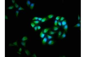 Immunofluorescence staining of Hela cells with ABIN7146901 at 1:40, counter-stained with DAPI. (FLIP Antikörper  (AA 1-250))
