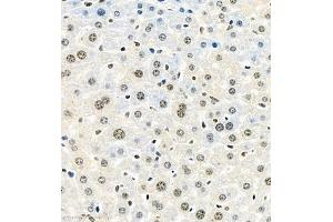 Immunohistochemistry of paraffin embedded mouse liver using HIF-3α (ABIN7074273) at dilution of 1:1600 (400x lens) (HIF3A Antikörper)