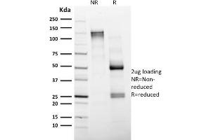 SDS-PAGE Analysis Purified CD4 Mouse Monoclonal Antibody (CD4/1604). (CD4 Antikörper  (AA 245-392))