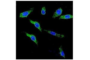 IF analysis of KCNH1 using anti-KCNH1 antibody (ABIN6719590).
