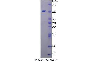 Image no. 1 for Protein Phosphatase, Mg2+/Mn2+ Dependent, 1A (PPM1A) (AA 2-382) protein (His tag) (ABIN4990690)