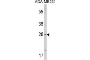 Western Blotting (WB) image for anti-Collectin Sub-Family Member 11 (COLEC11) antibody (ABIN3002827)