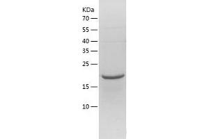 NKIRAS2 Protein (AA 1-191) (His tag)
