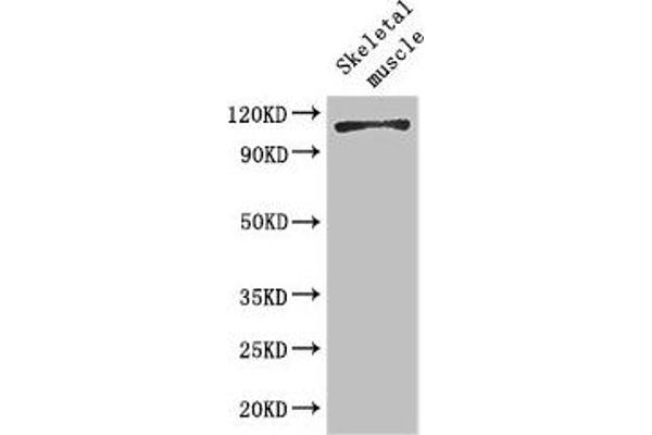 EPH Receptor B6 Antikörper  (AA 410-553)