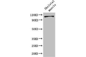 Western Blot Positive WB detected in: Mouse skeletal muscle tissue All lanes: EPHB6 antibody at 2 μg/mL Secondary Goat polyclonal to rabbit IgG at 1/50000 dilution Predicted band size: 111, 82, 58 kDa Observed band size: 111 kDa (EPH Receptor B6 Antikörper  (AA 410-553))