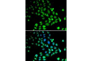 Immunofluorescence analysis of U2OS cells using PARN antibody (ABIN1681249, ABIN3018397, ABIN3018398 and ABIN6220460). (PARN Antikörper  (AA 1-280))