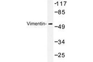 Western blot analyzes of Vimentin antibody in extracts from A549 cells. (Vimentin Antikörper)