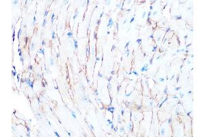 Immunohistochemistry of paraffin-embedded mouse heart using Dystrophin Rabbit mAb (ABIN7266871) at dilution of 1:100 (40x lens). (Dystrophin Antikörper)