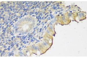 Immunohistochemistry of paraffin-embedded Human appendix using CLN5 Polyclonal Antibody at dilution of 1:150 (40x lens). (CLN5 Antikörper)