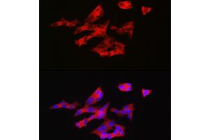 Immunofluorescence analysis of SH-SY5Y cells using GNRH1 Rabbit pAb (ABIN6131875, ABIN6141257, ABIN6141258 and ABIN6221260) at dilution of 1:200 (40x lens).