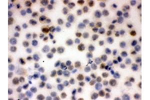 Immunohistochemistry (IHC) image for anti-Sialophorin (SPN) (AA 272-400) antibody (ABIN3042491)