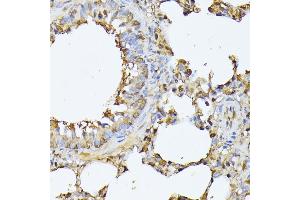 Immunohistochemistry of paraffin-embedded rat lung using PSMB3 antibody (ABIN6131929, ABIN6146317, ABIN6146318 and ABIN6225280) at dilution of 1:100 (40x lens). (PSMB3 Antikörper  (AA 1-205))