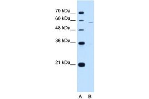 PIGV antibody used at 1 ug/ml to detect target protein. (PIGV Antikörper  (N-Term))