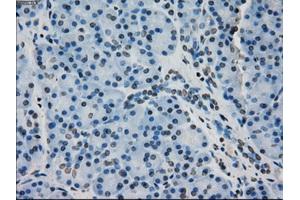 Immunohistochemical staining of paraffin-embedded pancreas tissue using anti-CRYABmouse monoclonal antibody. (CRYAB Antikörper)