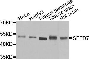 Western blot analysis of extracts of various cell lines, using SETD7 antibody. (SETD7 Antikörper)