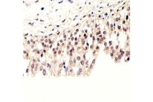 Immunohistochemical analysis of paraffin-embedded H. (Pan SUMO Antikörper)