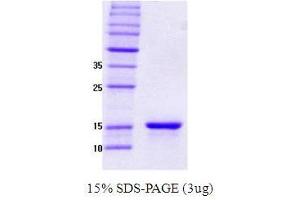 Figure annotation denotes ug of protein loaded and % gel used. (SNCG Protein)
