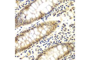 Immunohistochemistry of paraffin-embedded human colon using GNB2L1 antibody. (GNB2L1 Antikörper)