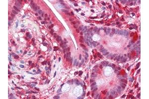 Immunohistochemical analysis of paraffin-embedded human Small Intestine tissues using PAR4 antibody (F2RL3 Antikörper  (AA 1-330))