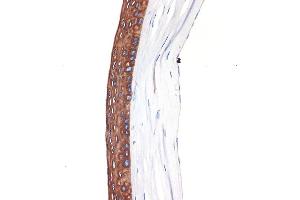 Immunohistochemistry (IHC) image for anti-Keratin 12 (KRT12) antibody (ABIN7268087)