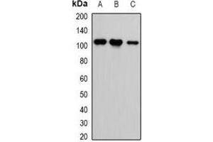 Western blot analysis of CASK expression in HEK293T (A), H460 (B), A549 (C) whole cell lysates. (CASK Antikörper)