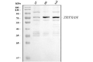 Western blot analysis of ZBTB48 using anti-ZBTB48 antibody (ABIN7599504).