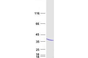 Validation with Western Blot