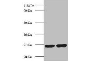 Western blot All lanes: Proteasome subunit beta 1 antibody at 2 μg/mL Lane 1: EC109 whole cell lysate Lane 2: 293T whole cell lysate Secondary Goat polyclonal to rabbit IgG at 1/15000 dilution Predicted band size: 27 kDa Observed band size: 27 kDa (PSMB1 Antikörper  (AA 29-241))