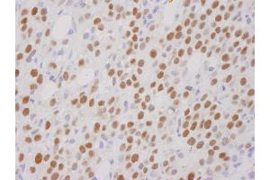 Immunohistochemistry (IHC) image for anti-REST Corepressor 1 (RCOR1) (C-Term) antibody (ABIN7448481) (CoREST Antikörper  (C-Term))