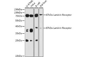Western blot analysis of extracts of various cell lines, using 67 kDa Laminin Receptor antibody (ABIN6128199, ABIN6147247, ABIN6147248 and ABIN6224857) at 1:3000 dilution. (RPSA/Laminin Receptor Antikörper  (AA 1-295))