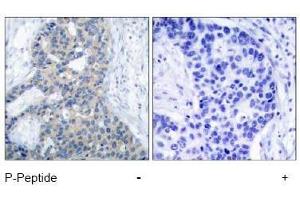 Image no. 1 for anti-Stathmin 1 (STMN1) (pSer37) antibody (ABIN196971) (Stathmin 1 Antikörper  (pSer37))