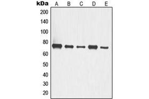 Western blot analysis of p63 expression in A549 (A), HCT116 (B), COLO205 (C), LOVO (D), HT29 (E) whole cell lysates. (TCP1 alpha/CCTA Antikörper  (C-Term))
