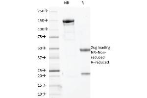 SDS-PAGE Analysis Purified Myogenin Mouse Monoclonal Antibody (MYOG/2660).