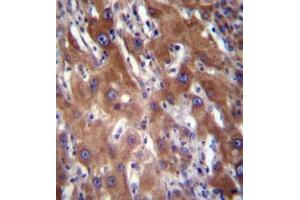 Immunohistochemistry analysis in formalin fixed and paraffin embedded human liver tissue reacted with GNE / GLCNE Antibody (N-term) followed by peroxidase conjugation of the secondary antibody and DAB staining. (GNE Antikörper  (N-Term))