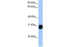 IGFBP7 antibody used at 1 ug/ml to detect target protein.