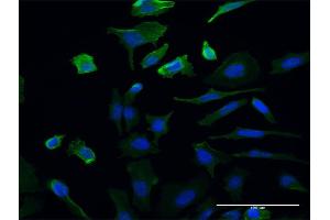 Immunofluorescence of monoclonal antibody to UMPS on HeLa cell.