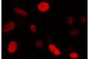 ABIN6274340 staining Hela cells by IF/ICC.
