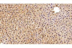 Detection of FABP1 in Rat Liver Tissue using Polyclonal Antibody to Fatty Acid Binding Protein 1 (FABP1) (FABP1 Antikörper  (AA 2-127))