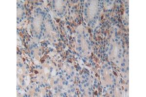 IHC-P analysis of Kidney tissue, with DAB staining. (MGA Antikörper  (AA 2450-2733))